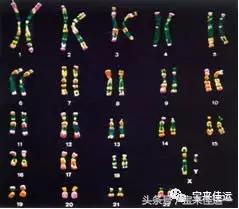 做试管婴儿之前要做染色体检查吗,第三代试管婴儿筛查几对染色体