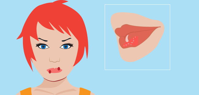 狗舔另外一只狗的嘴,被狗舔嘴有什么危害吗