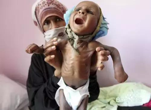 4岁宝宝太瘦了如何能长胖,宝宝越来越瘦怎么办