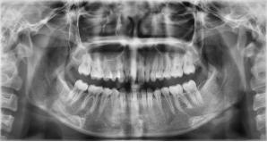 牙科病人检查的基本方法,牙科问诊技巧