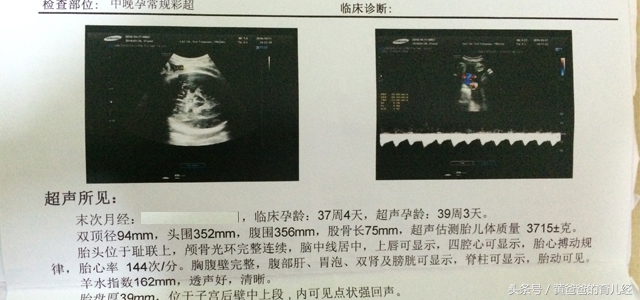 孕期想检查羊水是否正常,孕期看化验单