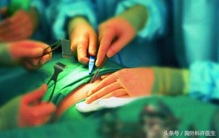 胸腔镜手术会很痛吗,胸腔镜手术很痛吗
