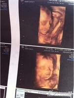 怎么才能知道肚子里的孩子是男女,多久可以知道肚子里孩子是男女