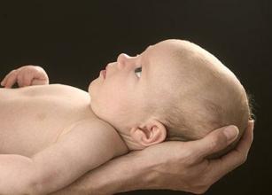 如何缓解宝宝湿疹瘙痒,如何缓解宝宝湿疹的痒