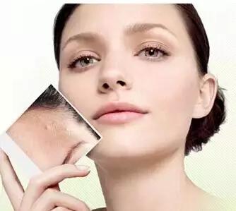 如何才能使脸美白去痘印,怎么快速一夜之间祛痘