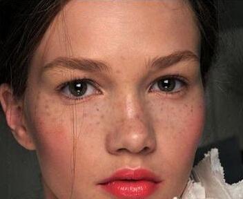 斑点的原因和改善方法,斑点问题怎么解决