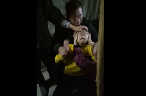 男子学狗叫咬人是狂犬病吗,门口狗叫引起男子狂犬病后续