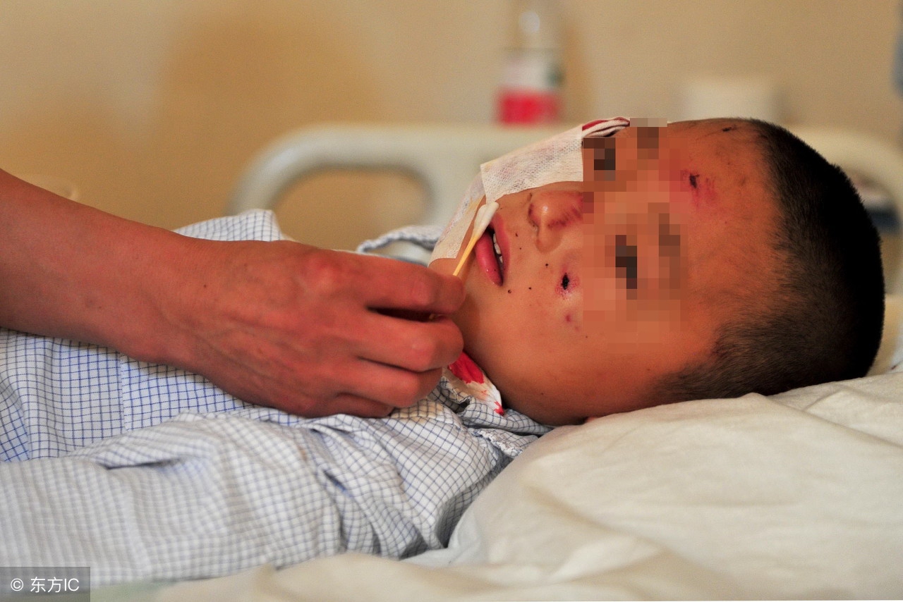 恐狂症与狂犬病的敏感区别,恐狂是什么