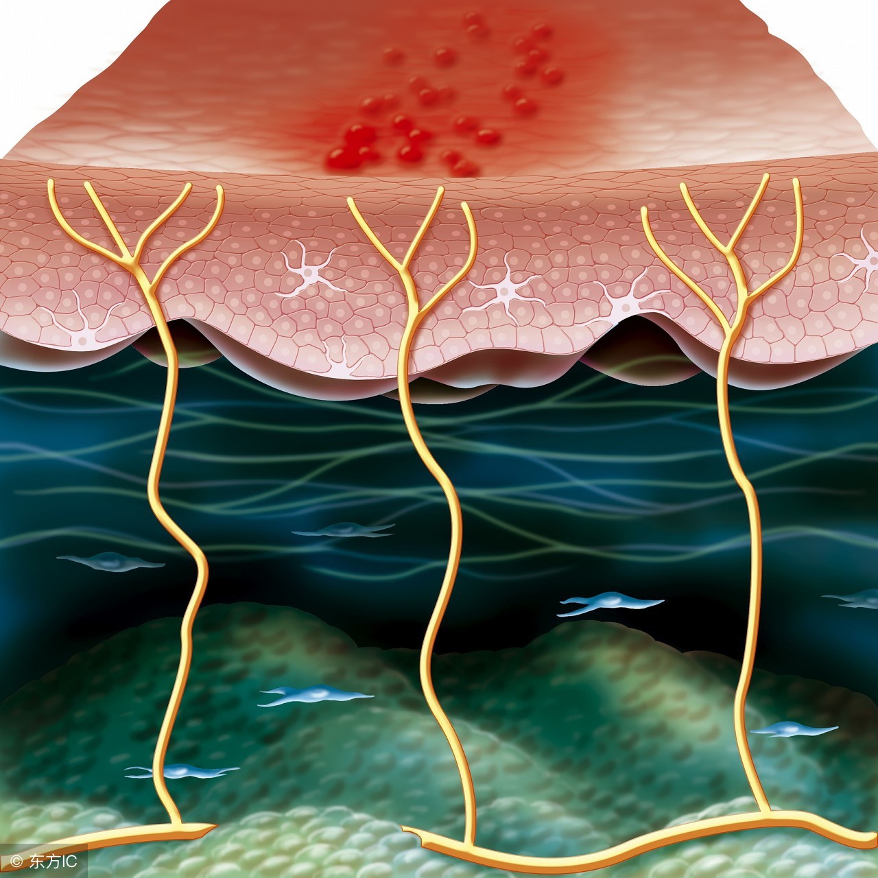 生殖器疱疹疾病预防和治疗,生殖器疱疹预防的常识