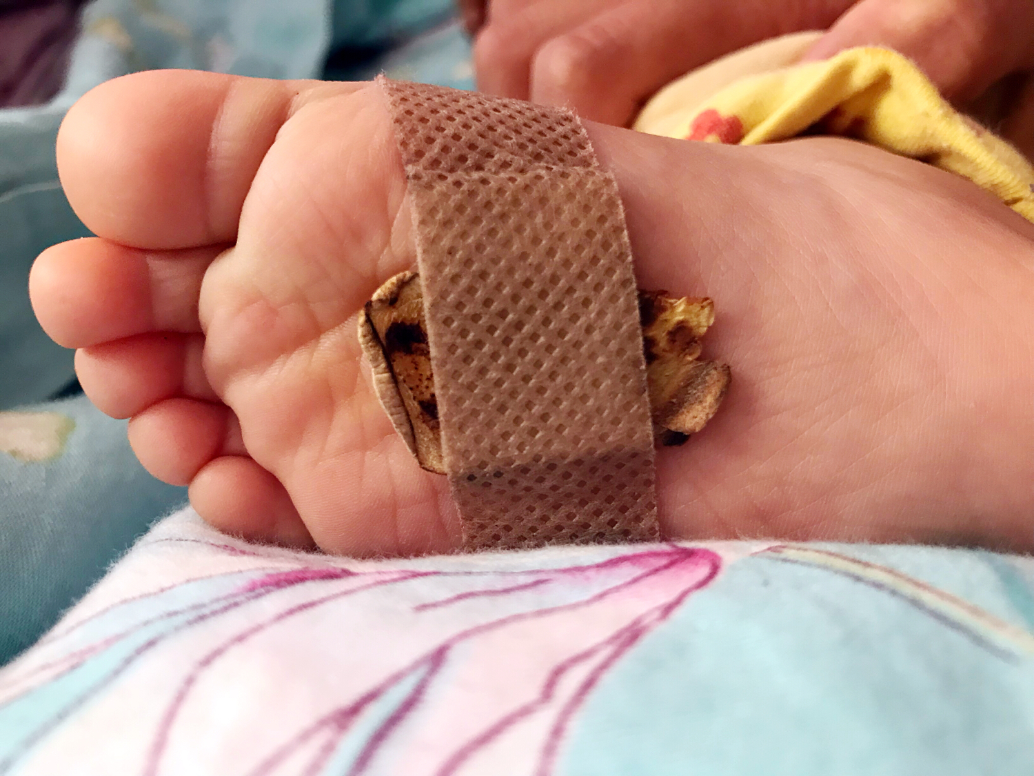 宝宝着凉感冒怎么能快速治好呢,小孩着凉感冒咳嗽快速止咳小妙招