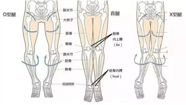 部队矫正o型腿绑腿正确方法,一岁多的孩子o型腿怎么矫正