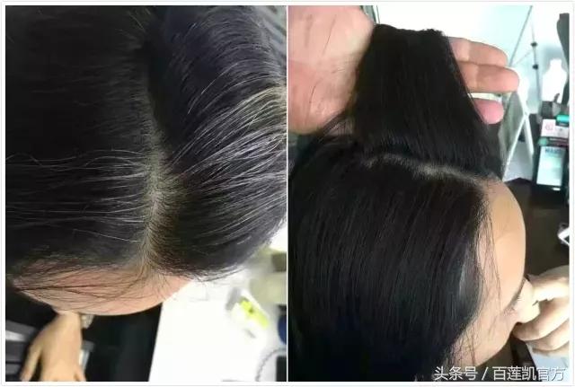 百莲凯科技养发馆洗头流程,百莲凯科技养发馆治疗效果怎么样