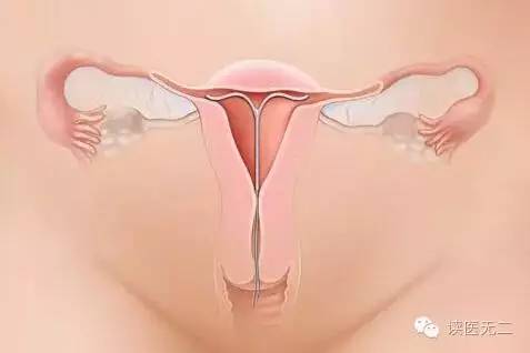 第四代避孕药怎么样,第4代避孕药有哪些