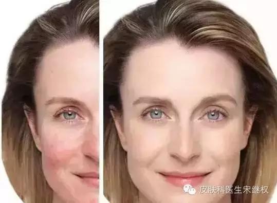 我要的人面桃花，绝不是*血丝红**