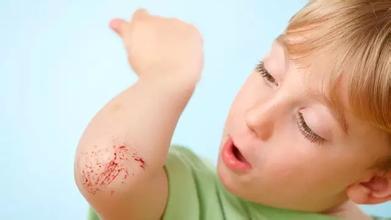 受伤了怕留疤该做些什么,如何处理刀疤不留疤痕