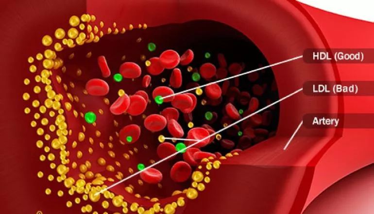 代谢综合征通过运动能治愈吗,代谢综合征