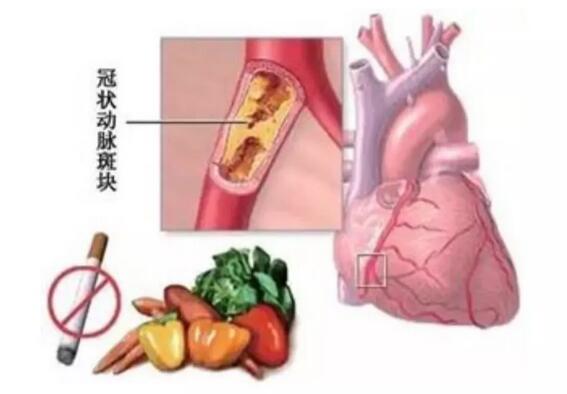 安钢总医院名医系列推送活动之——心血管内科专家李东旺