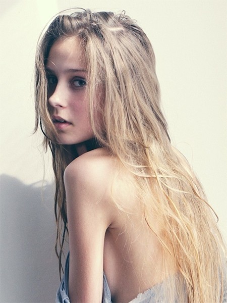 头皮屑多怎么办？做到这些让你无“屑“