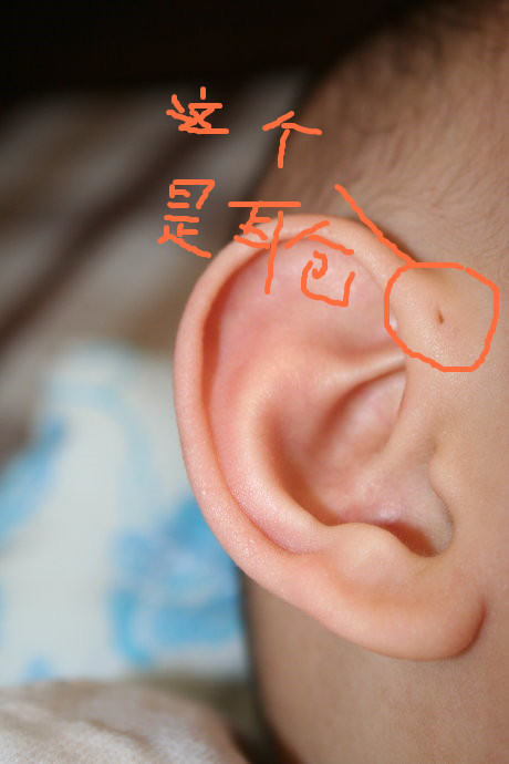 右耳有耳仓代表什么福气,女孩有耳仓是什么福气