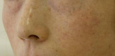 揭秘神奇的面部排毒按摩一招解决N种肌肤问题不反弹