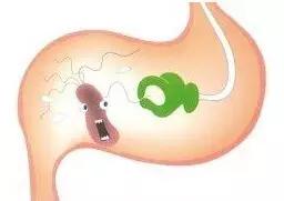 消除胃结石选苏打水还是可乐,什么情况的胃结石不能用可乐治疗