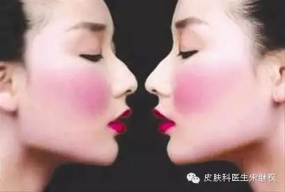 我要的人面桃花，绝不是*血丝红**