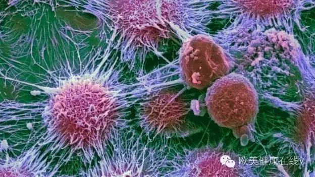 癌症的奇效良方,癌症新疗法