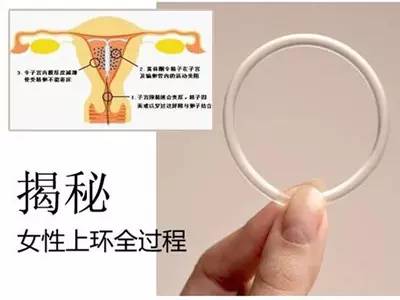 什么样的女性不适合上环,单身女性上环是什么心态