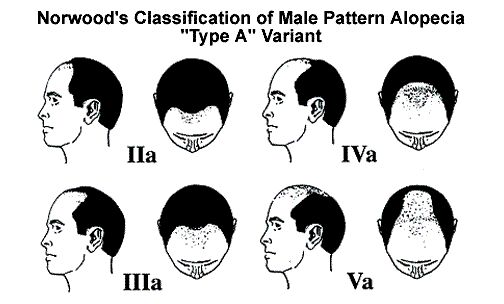 上帝给你留的窗，你开不开