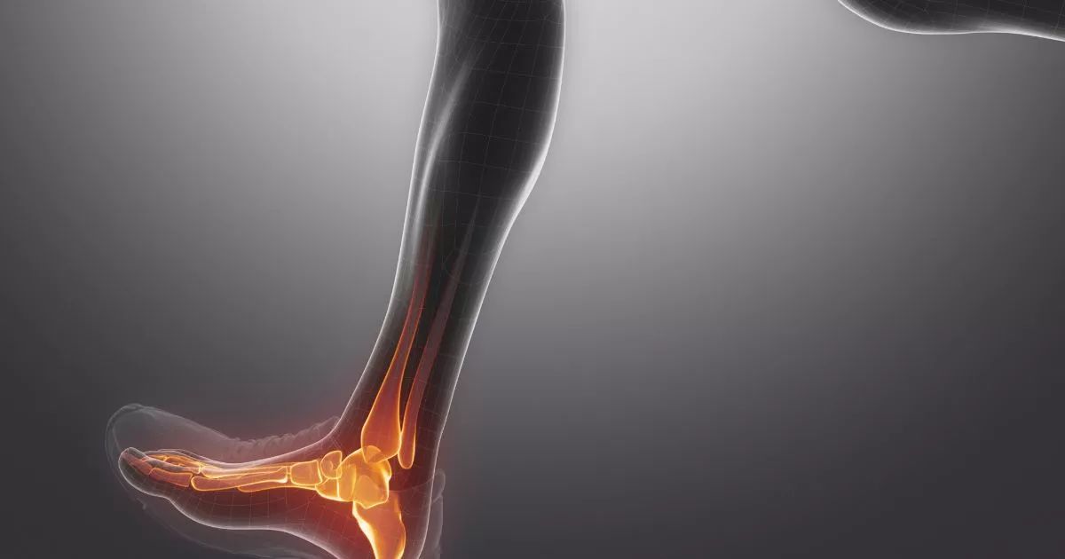 跑步六大伤痛解决方案,跑步简直是自愈的最佳方法