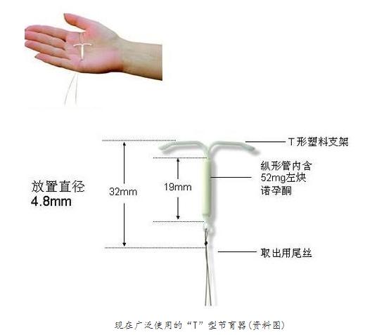 你被逼上环了吗？女性上环全过程，简直就像命案现场！