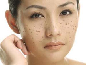 药吃多了会长色斑吗,反复刺激色斑