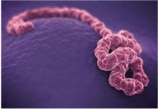 埃博拉病毒是不是彻底消灭了,埃博拉病毒大爆发