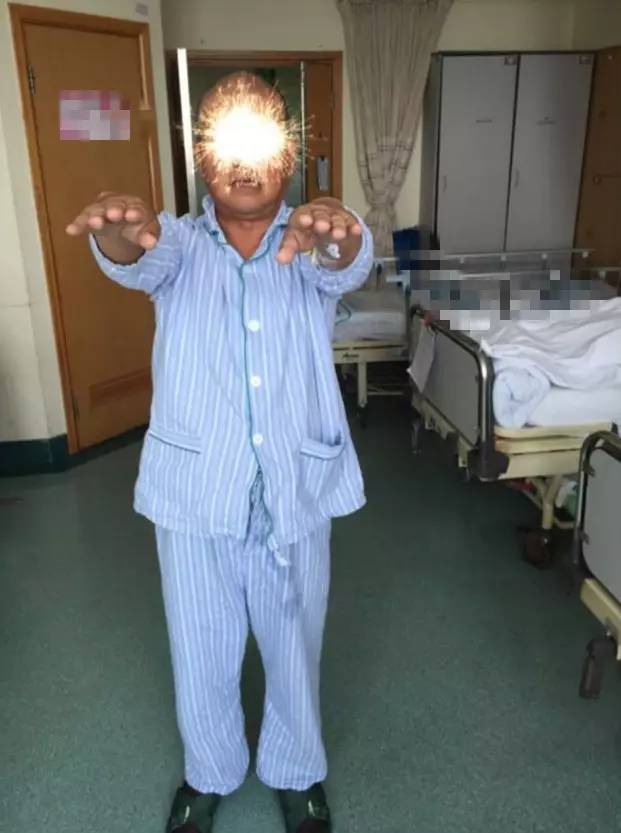 市人民医院取栓手术的全过程,病例分享视频素材