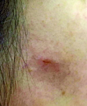 苹果钢化膜为什么会无缘无故裂掉,苹果钢化膜一碰就碎怎么回事