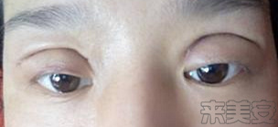 嘿医生直播,嘿医生