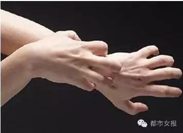 用了这么多年风油精，原来只知道它1%的功能！