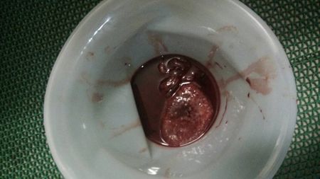 药流都会造成哪些后果,药流的副作用和风险