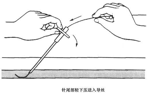 超声引导下改良塞丁格技术解剖图,超声引导下pdca置管