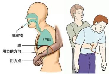 宝宝被鱼刺卡喉怎么处理,宝宝被鱼刺卡到怎么办
