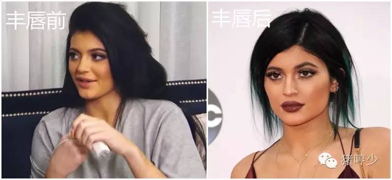 庆幸，男女通杀的Plump唇不用动刀