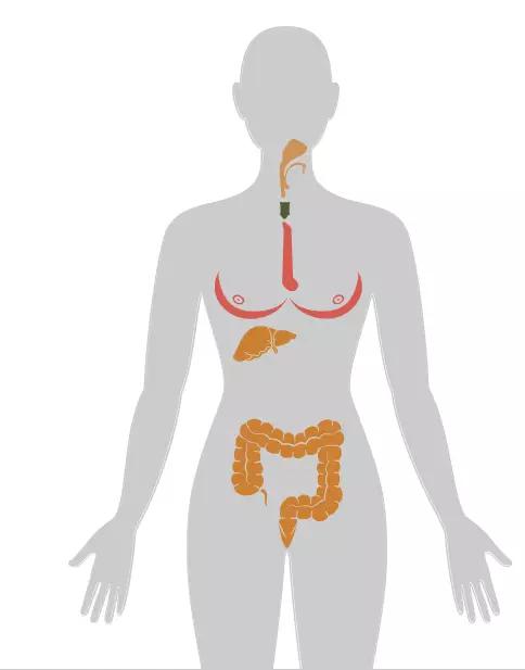 20张癌症人体地图告诉你致癌真相,2020癌症数据报告