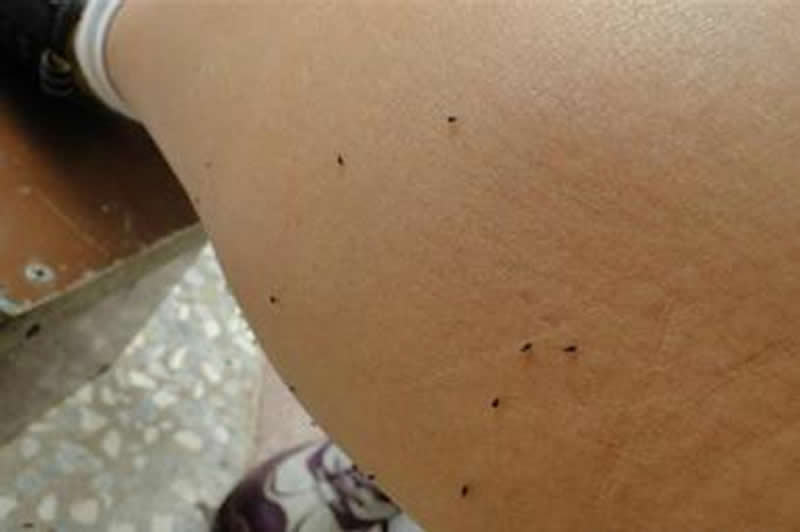 你被蚊子咬了吗是什么梗,四川墨蚊咬了以后怎么治疗