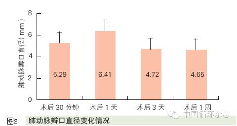 上海儿童医学中心肺动脉闭锁,婴儿肺动脉闭锁手术大吗