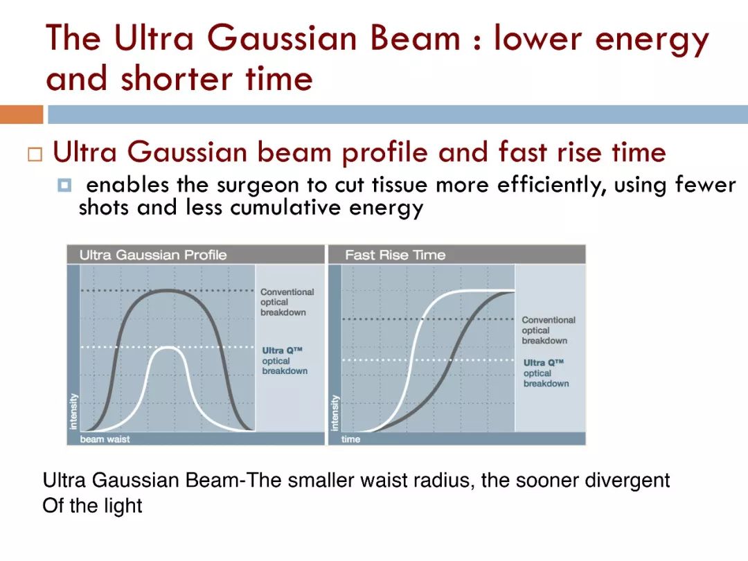 精准安全，无创无忧——UltraQReflex激光玻璃体消融术（LFR）