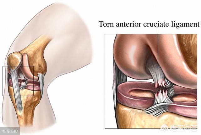 韧带跟筋有什么区别,韧带和骨头断哪个严重