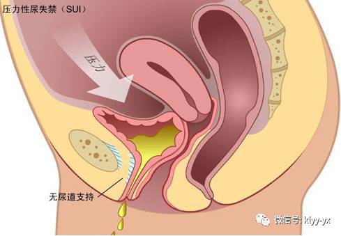生娃后被老公嫌弃了吗,生完孩子后老公嫌弃该怎么办