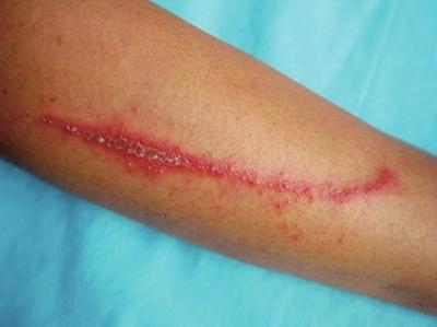 这种小虫子有这么厉害？还能要死人？