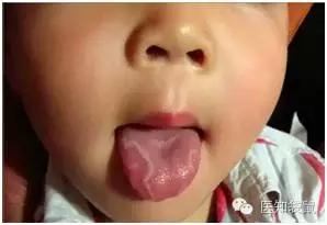 你的宝宝是否缺钙铁锌,你的孩子是不是需要补锌了