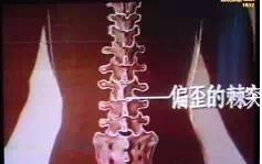 新医正骨手法实用指南,正骨常用的触诊手法